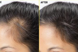 ருமேனியாவில் புகலிடம் கோரி விண்ணப்பிப்பது எப்படி?