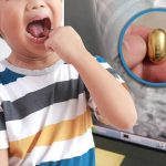 சிங்கப்பூர் மக்களை அச்சுறுத்தும் நோய் – சுகாதார அதிகாரிகள் விடுத்துள்ள எச்சரிக்கை