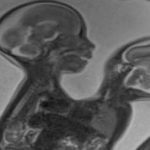 இலங்கையில் 10000 ரூபாயால் அதிகரித்த தங்கத்தின் விலை!