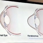 (update) தலாவ பேருந்து விபத்து தொடர்பில் சாரதி கைது!