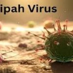 கதிரியக்க தொழில்நுட்பவியலாளர்கள் நாளை நாடு தழுவிய பணிப்புறக்கணிப்பு