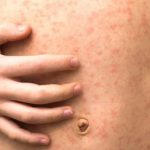 வவுனியாவில் 8000 பெண் தலைமைத்துவக் குடும்பங்கள் அடையாளம்!