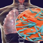 அமெரிக்காவில் குறைந்தது 59 வாகனங்கள் ஒன்றுடன் ஒன்று மோதி விபத்து!